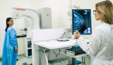 Ce înseamnă BI-RADS 5 și care sunt pașii următori